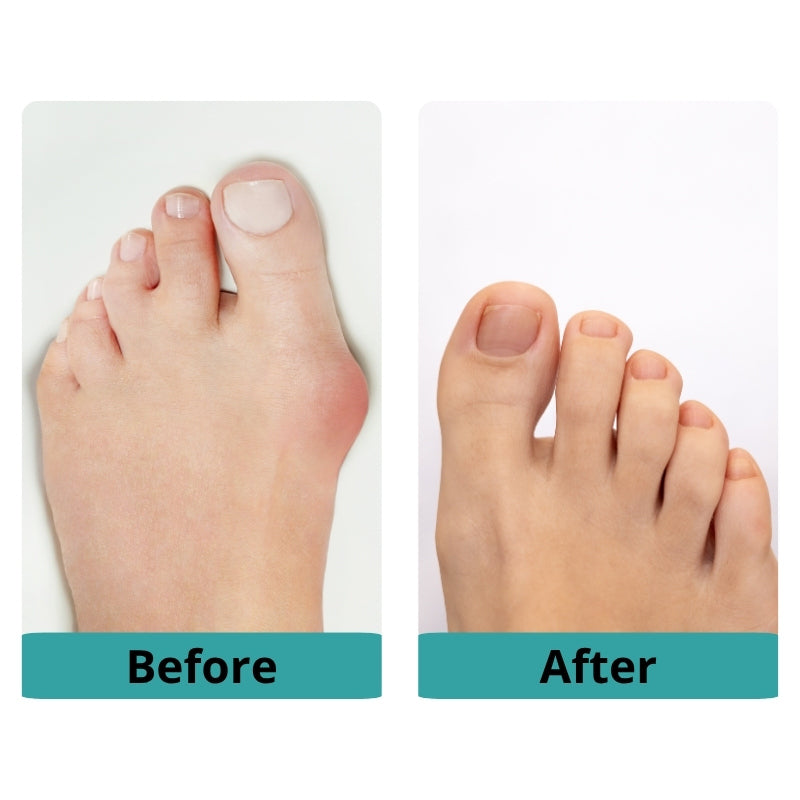 Toe Separator